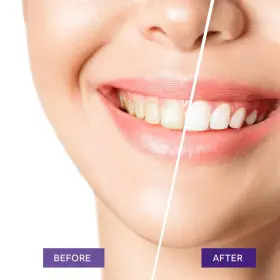 809945040148 ANAREAL Toothpaste Whitening #2