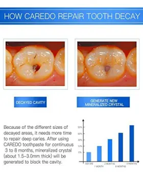 897093130075 CAREDO Toothpaste Treatment Decay Cavity Repair #3