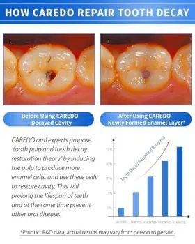 897093130082 CAREDO Cavity Repair Toothpaste Set Pulpitis #3