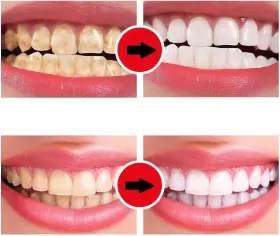 290962935215 EDMER Ultra Probiotic Whitening Toothpastesp #3