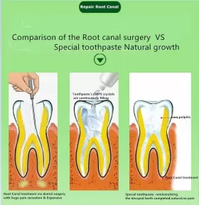 768523865451 FORTIDENT Toothpaste Gum Care Root Canal Treat #3