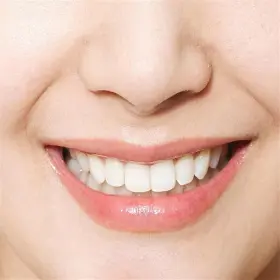 313100333375 GROLOMO Niacinamide Toothpaste Whitening #2
