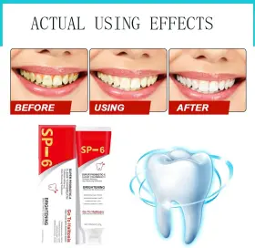 445043650684 JIANGZHIINC Toothpaste Ultra Whitening Sp #3