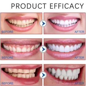 717352812990 JORLZEUT Probiotic Toothpaste Toothp #3