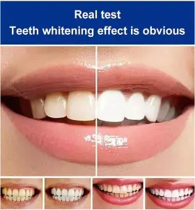 751753911463 KXC Probiotic Toothpaste Ultra Whitening Stain #3