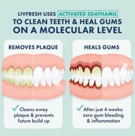 LIV1153 LIVIONEX Toothpaste Gel Clinically Remove Plaque Gum #2