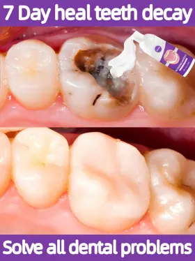 744760021904 TOOTH Mousse Repair Decay Removal #2