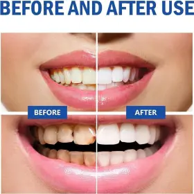 446219406487 NEWUREHO Probiotic Whitening Toothpaste #3
