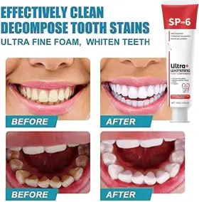 445025411418 SITUDAC Ultra Whitening Sp Toothpaste Probio #3