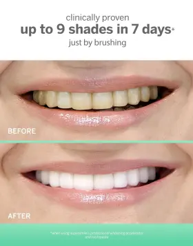 036179004297 SUPERSMILE Whitening Toothpaste Clinically #3