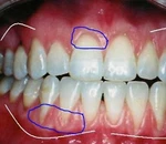 Buy 1 Get Free! Exclusive Patented Gum Paste To Grow & Stop Teeth Bleeding. Fixed Price $39.99.