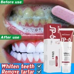 Sp-6 Probiotic Whitening Toothpaste Brightening&bad Breath Removing. Fixed Price $7.73.
